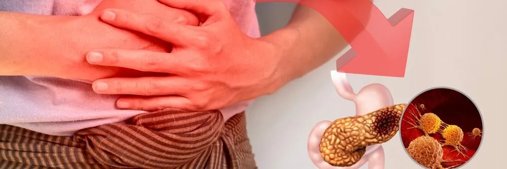 Ipertrigliceridemia: Usa, via libera alla prima terapia per ridurre il rischio di pancreatite acuta - AboutPharma