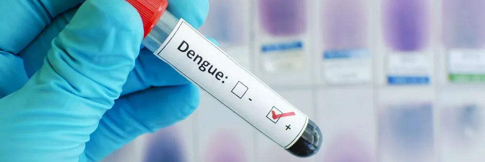 Dengue, la diffusione pretende un approccio globale oltre le emergenze - AboutPharma