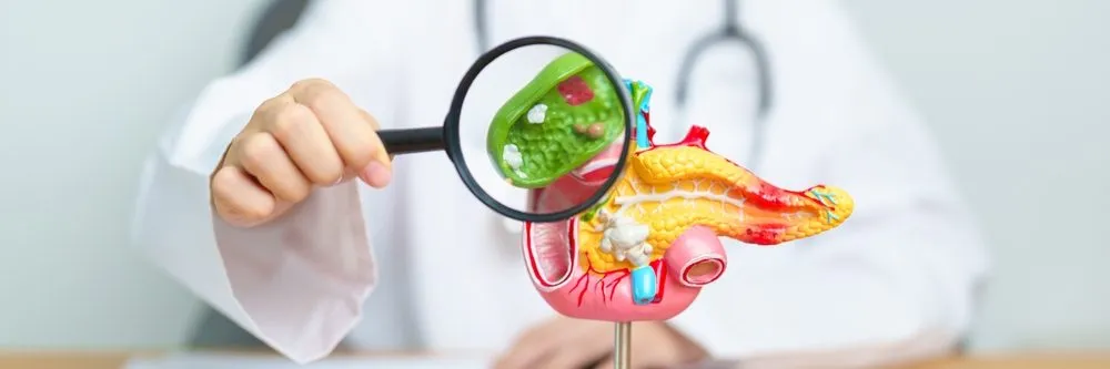 Fda approva daraxonrasib per il cancro al pancreas metastatico: raddoppiata la sopravvivenza - AboutPharma